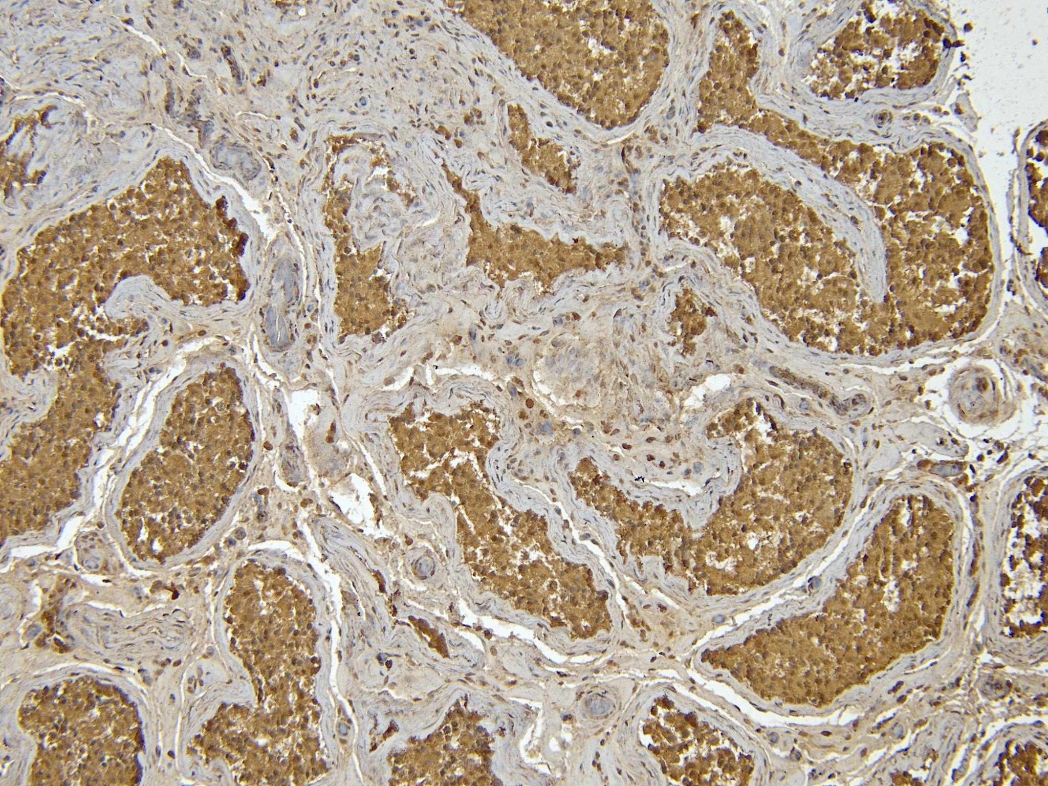 Goat Anti-Centromere protein F / mitosin Antibody