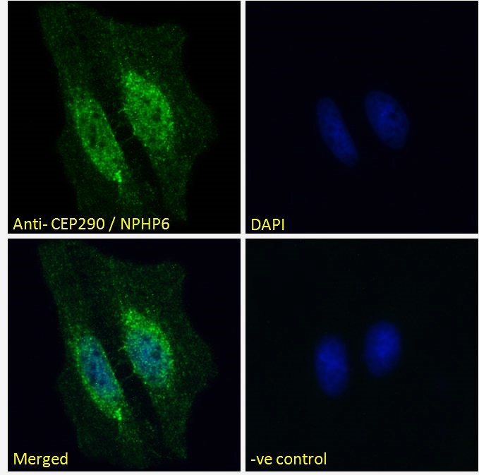 Goat Anti-CEP290 / NPHP6 Antibody