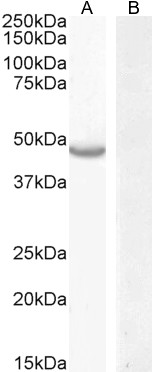 Goat Anti-CETP Antibody