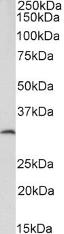 Goat Anti-CFD / adipsin (aa87-96) Antibody