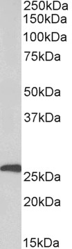 Goat Anti-CFD / adipsin Antibody