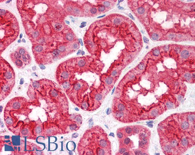 Goat Anti-CGI58 / ABHD5 Antibody