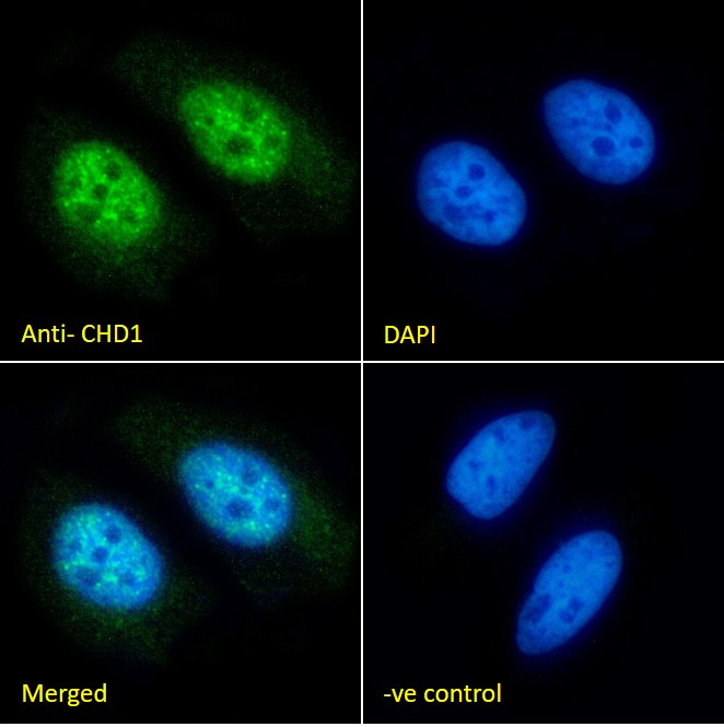 Goat Anti-CHD1 (internal) Antibody