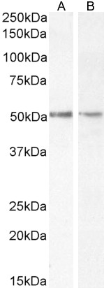 Goat Anti-Chromogranin A precursor Antibody