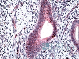 Goat Anti-CLCN2 Antibody