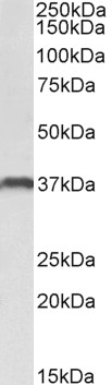 Goat Anti-CLEC12A / MICL Antibody