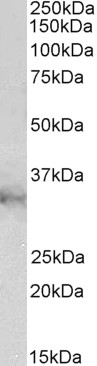 Goat Anti-CLIC1 / NCC27 Antibody