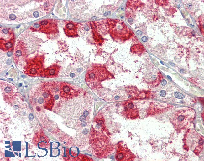 Goat Anti-CLTC  Antibody