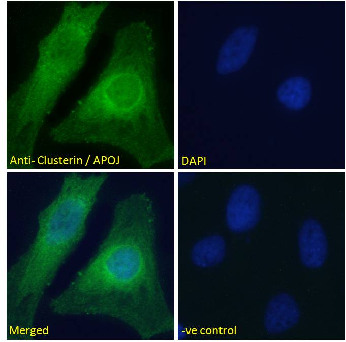 Goat Anti-Clusterin / APOJ Antibody