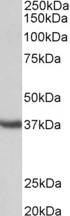 Goat Anti-Clusterin / ApoJ (mouse, aa312-325) Antibody