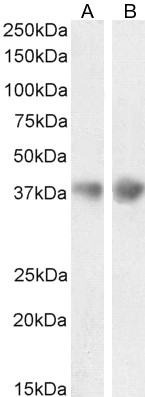 Goat Anti-Clusterin / ApoJ (mouse) Antibody