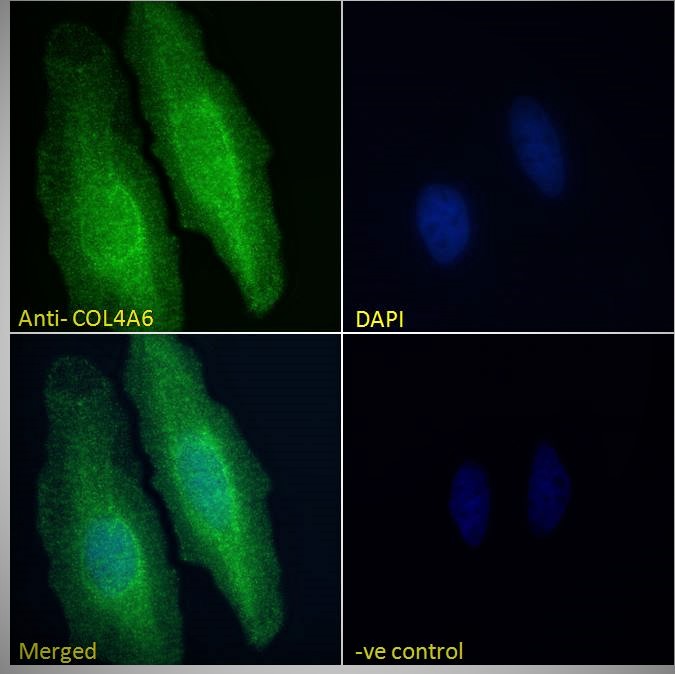 Goat Anti-COL4A6 Antibody