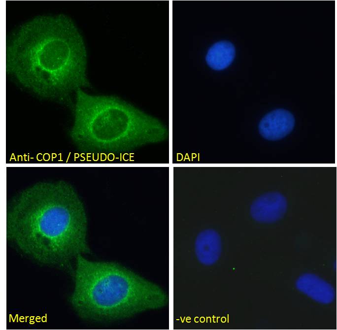 Goat Anti-COP1 / PSEUDO-ICE (Isofom 2) Antibody