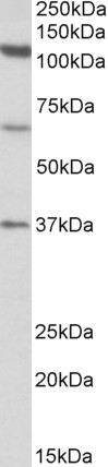 Goat Anti-CP110 Antibody