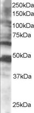 Goat Anti-CPEB1 Antibody
