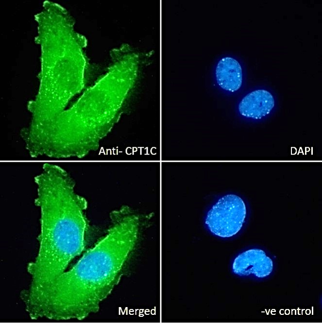 Goat Anti-CPT1C Antibody