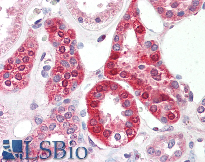 Goat Anti-Creatine transporter 1 / SLC6A8 Antibody