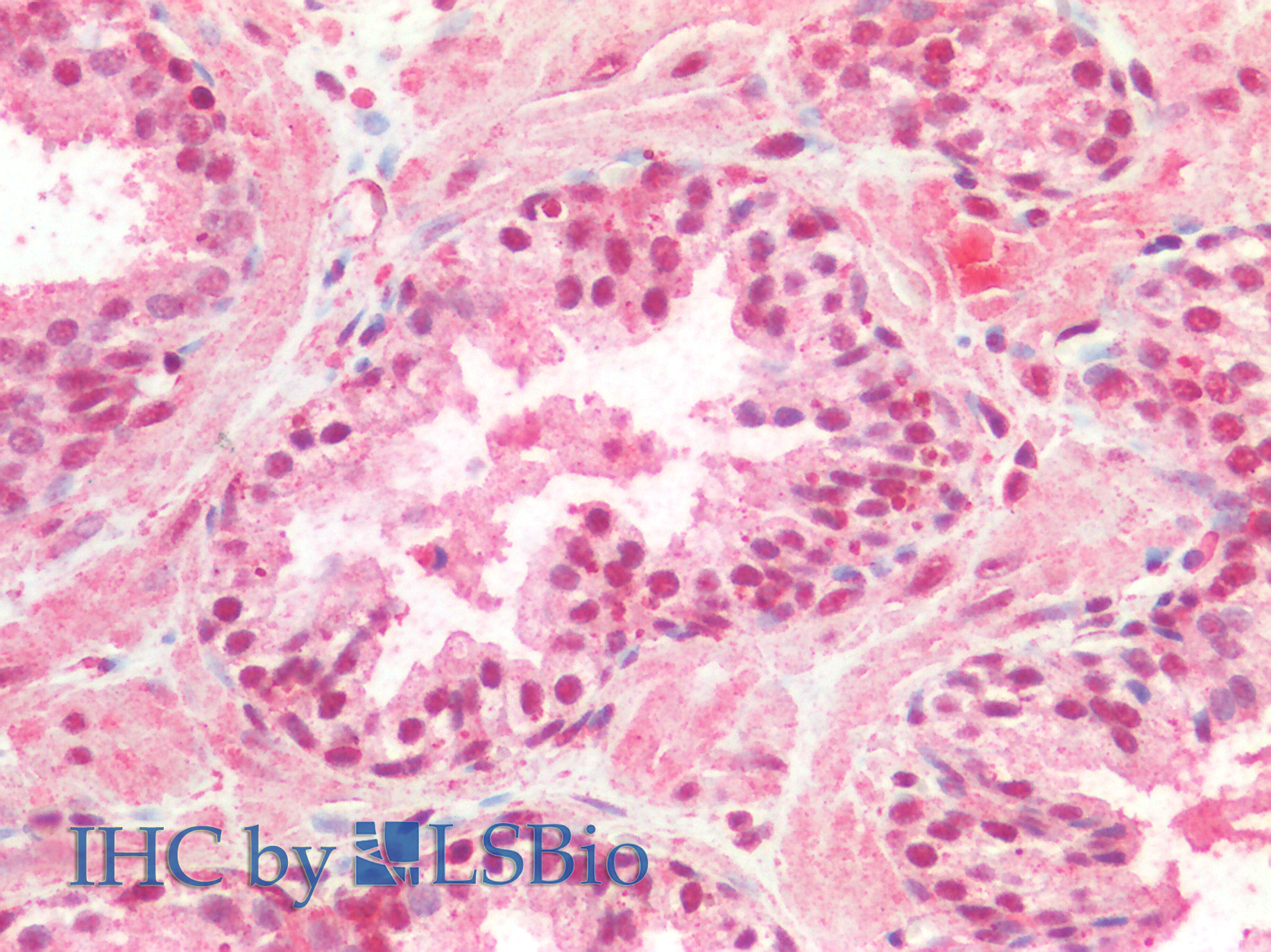 Goat Anti-CREB1 (aa96-109) Antibody