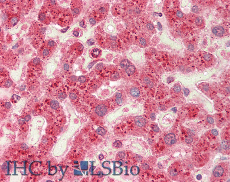 Goat Anti-Crot (rat) Antibody