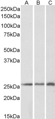 Goat Anti-CRP2 / CSRP2 Antibody