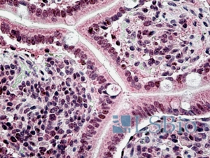 Goat Anti-CSB / ERCC6 Antibody