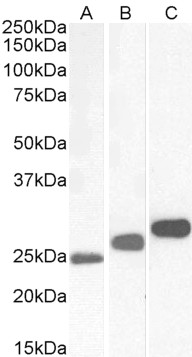 Goat Anti-CSNK2B Antibody