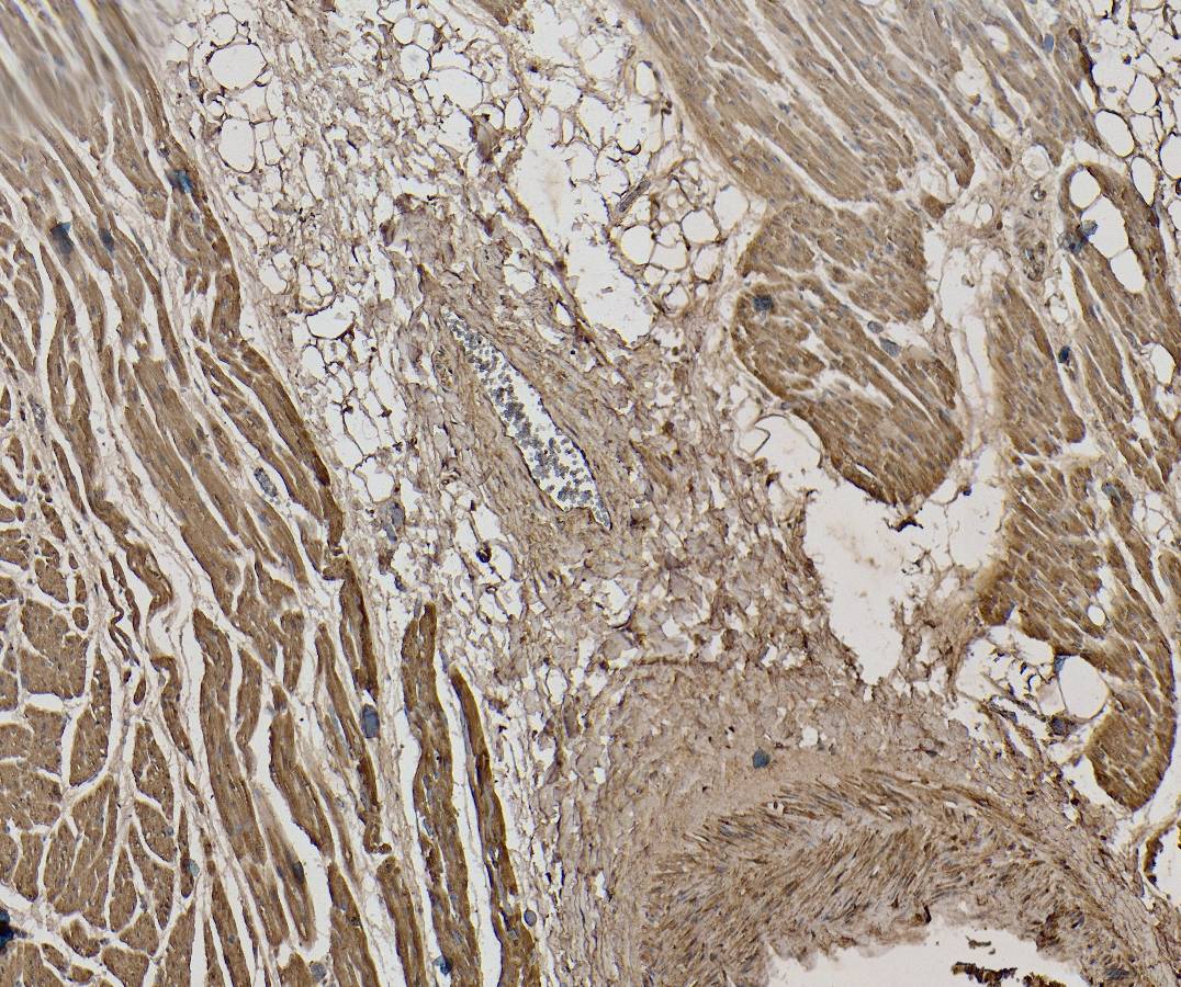 Goat Anti-CSX1 / NKX2-5 Antibody