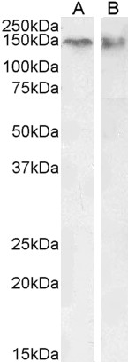 Goat Anti-CTCF (isoform 1) Antibody