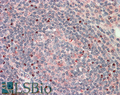 Goat Anti-CTDSP1 Antibody