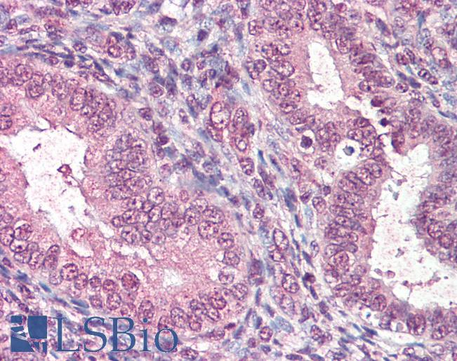 Goat Anti-CTDSP1 Antibody