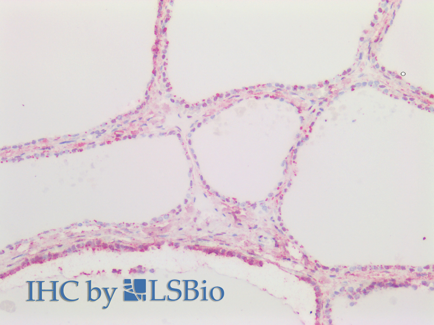 Goat Anti-CTGF (aa111-123) Antibody