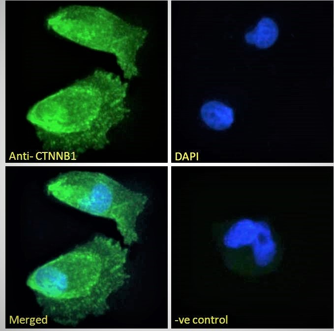 Goat Anti-CTNNB1 / catenin beta-1 Antibody