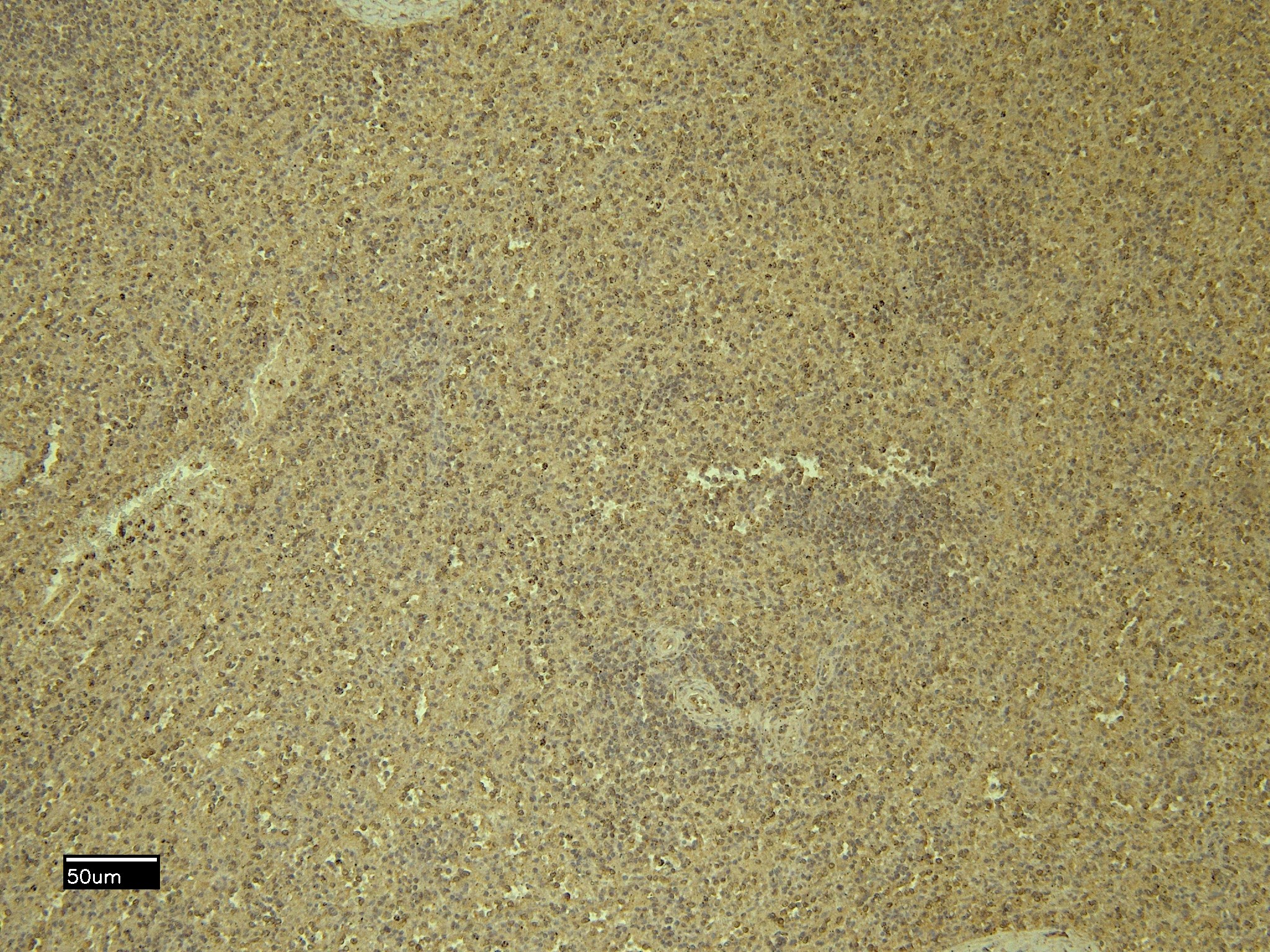 Goat Anti-CXCR3 / GPR9 Antibody