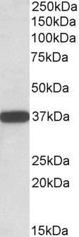 Goat Anti-CYB5R3 / Dia 1  Antibody