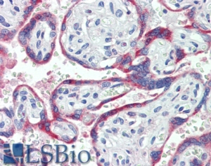 Goat Anti-CYBB / GP91-PHOX Antibody