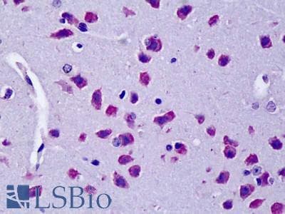 Goat Anti-Cyld (mouse) Antibody