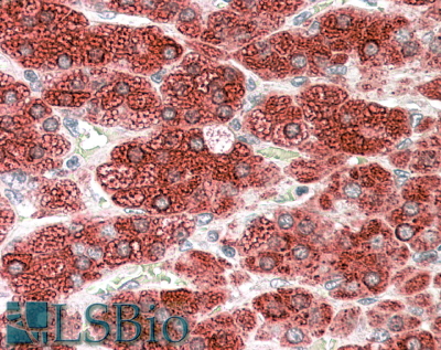 Goat Anti-CYP17A1 Antibody