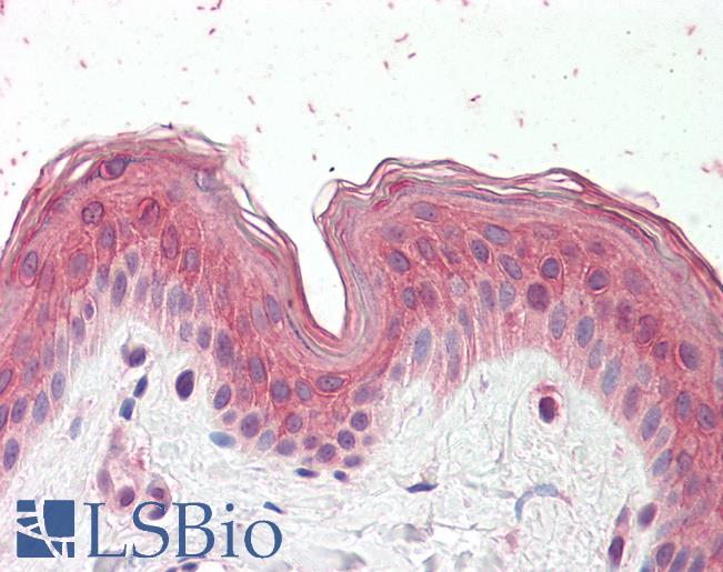 Goat Anti-CYP24A1 Antibody