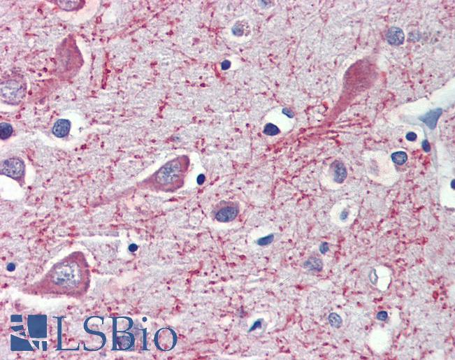 Goat Anti-CYP26A1  Antibody