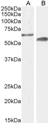 Goat Anti-Cyp2r1 (mouse aa405-418) Antibody