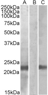 Goat Anti-Cystatin 8 (aa 100-112) Antibody