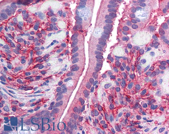 Goat Anti-Cytochrome b reductase 1 Antibody