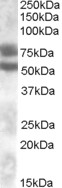 Goat Anti-Dachshund homolog 1 Antibody