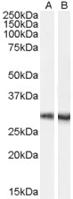 Goat Anti-Dcdc2a Antibody