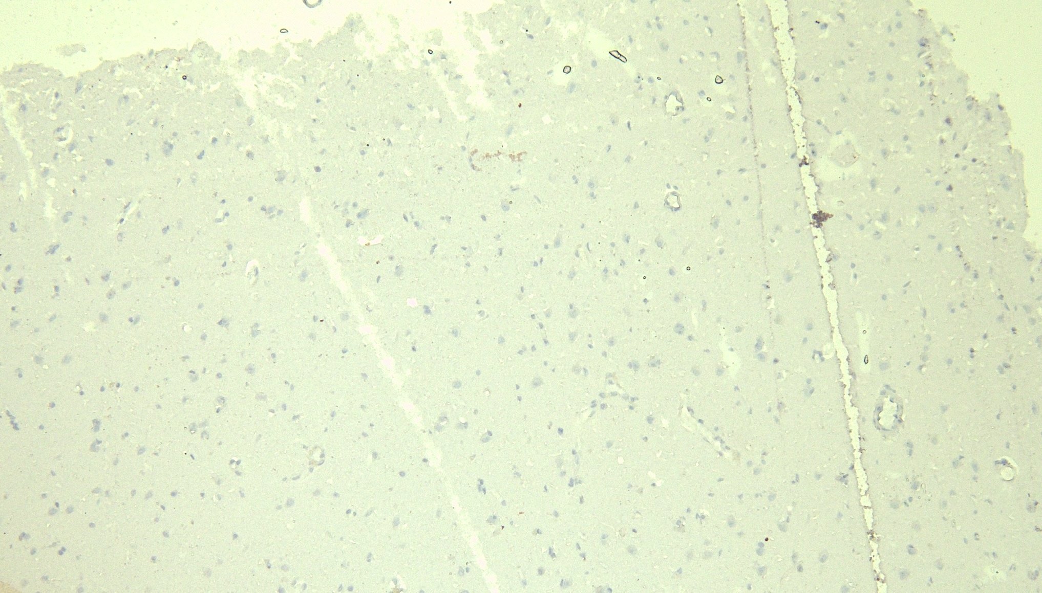 Goat Anti-DDB1 Antibody