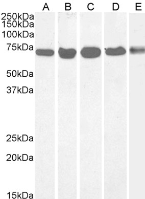 Goat Anti-DDX5 / p68 RNA helicase Antibody