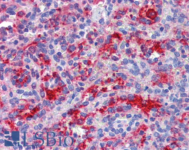 Goat Anti-DDX58 Antibody