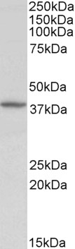 Goat Anti-Decorin Antibody