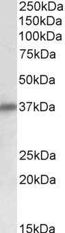 Goat Anti-Delta-Sarcoglycan (aa245-257) Antibody