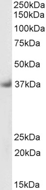 Goat Anti-Delta-Sarcoglycan (aa245-257), Biotinylated Antibody